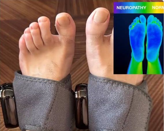 Thermal imaging showing blood flow improvement